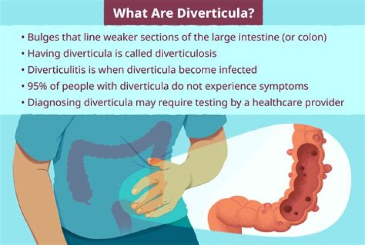 Are berries bad for diverticulitis