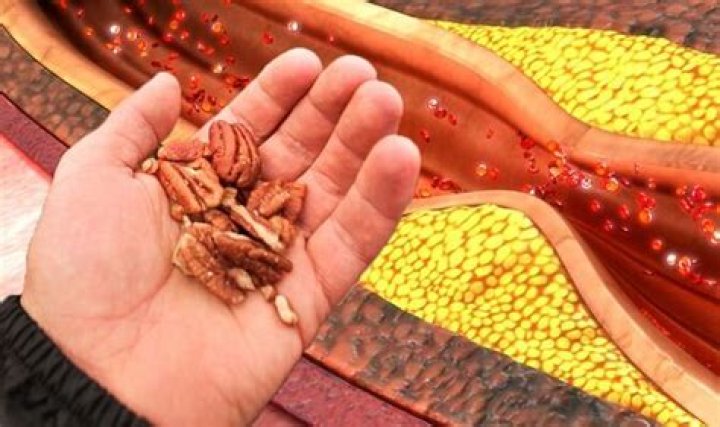 Are pecans bad for high cholesterol