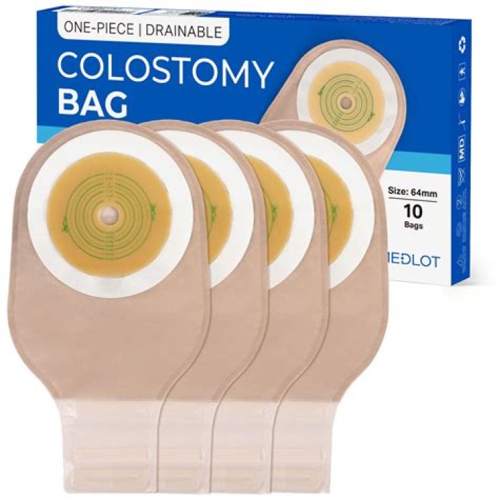 Are stoma bags permanent