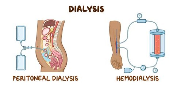 Are there different types of dialysis