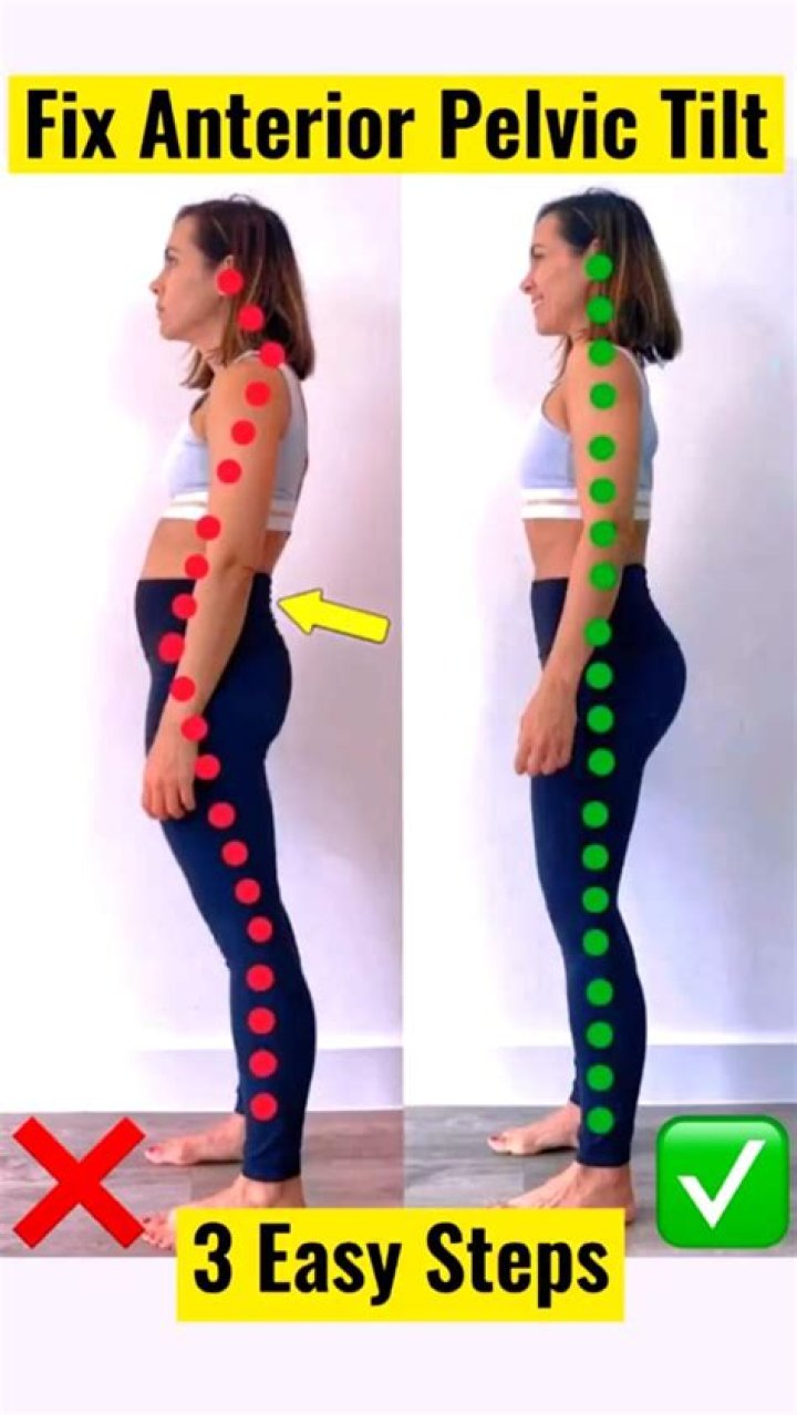 Can anterior pelvic tilt cause back pain