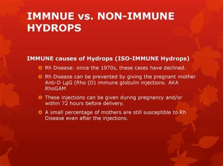 Can hydrops be prevented