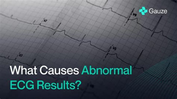 Can low electrolytes cause abnormal EKG