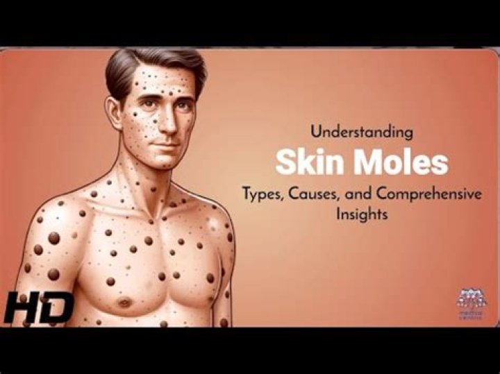 Can moles get in your walls