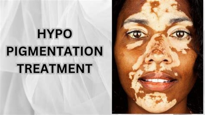 Can you fix hypopigmentation