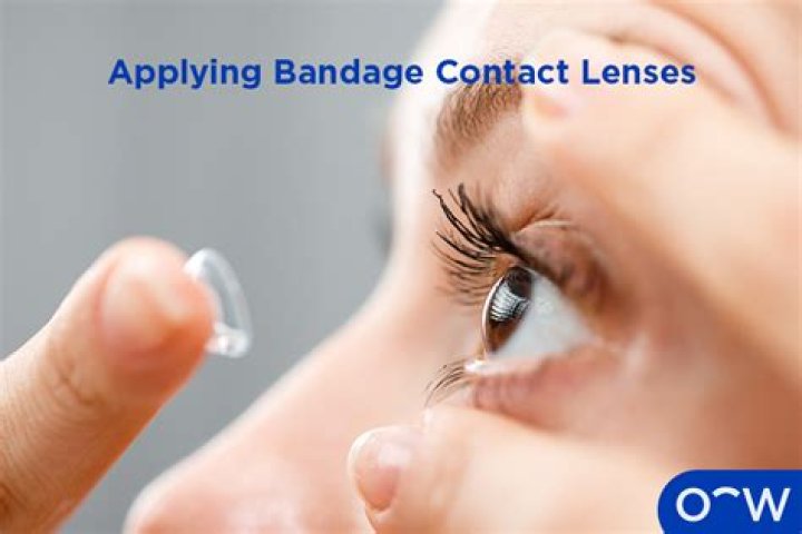 Can you see through bandage contact lens