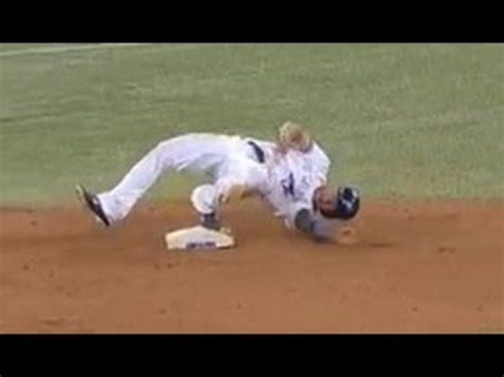 Does sliding in baseball hurt