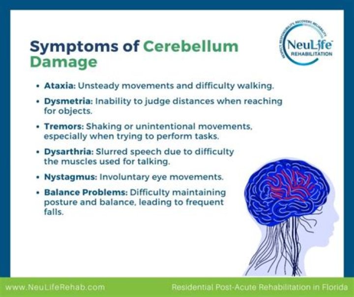 How can you damage your cerebellum
