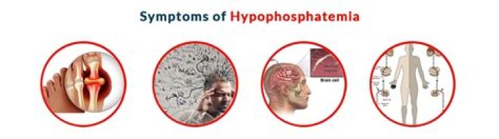 How common is Hypophosphatemia
