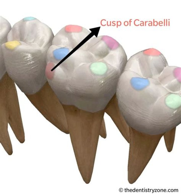 How common is the cusp of Carabelli