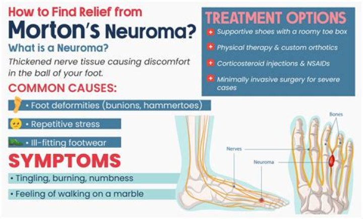 How do I treat myself with Mortons neuroma