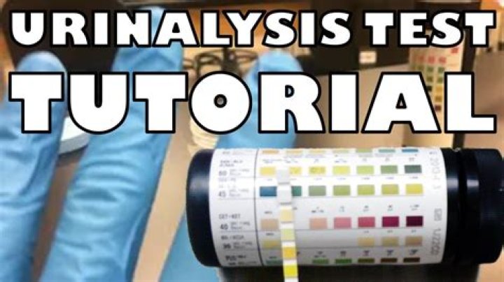 How do you bill a urinalysis