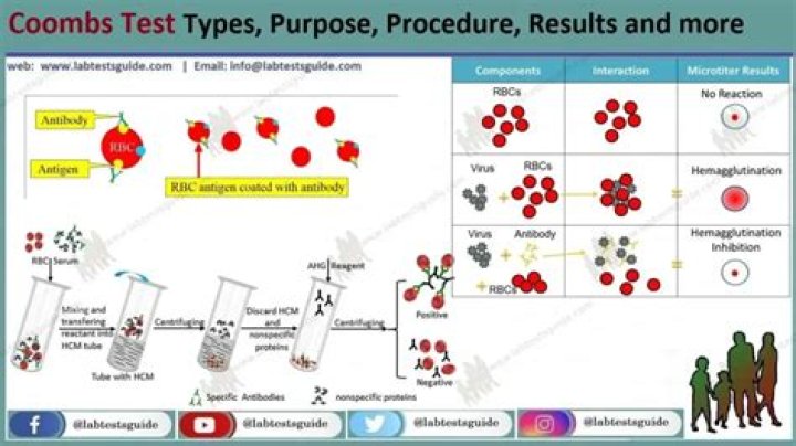 How do you code Coombs positive