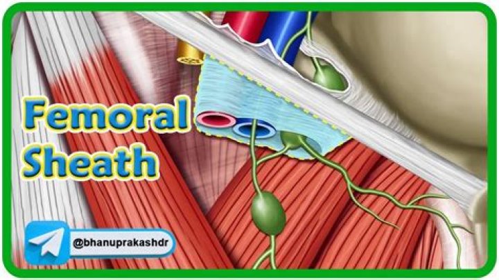 How do you pull a femoral sheath