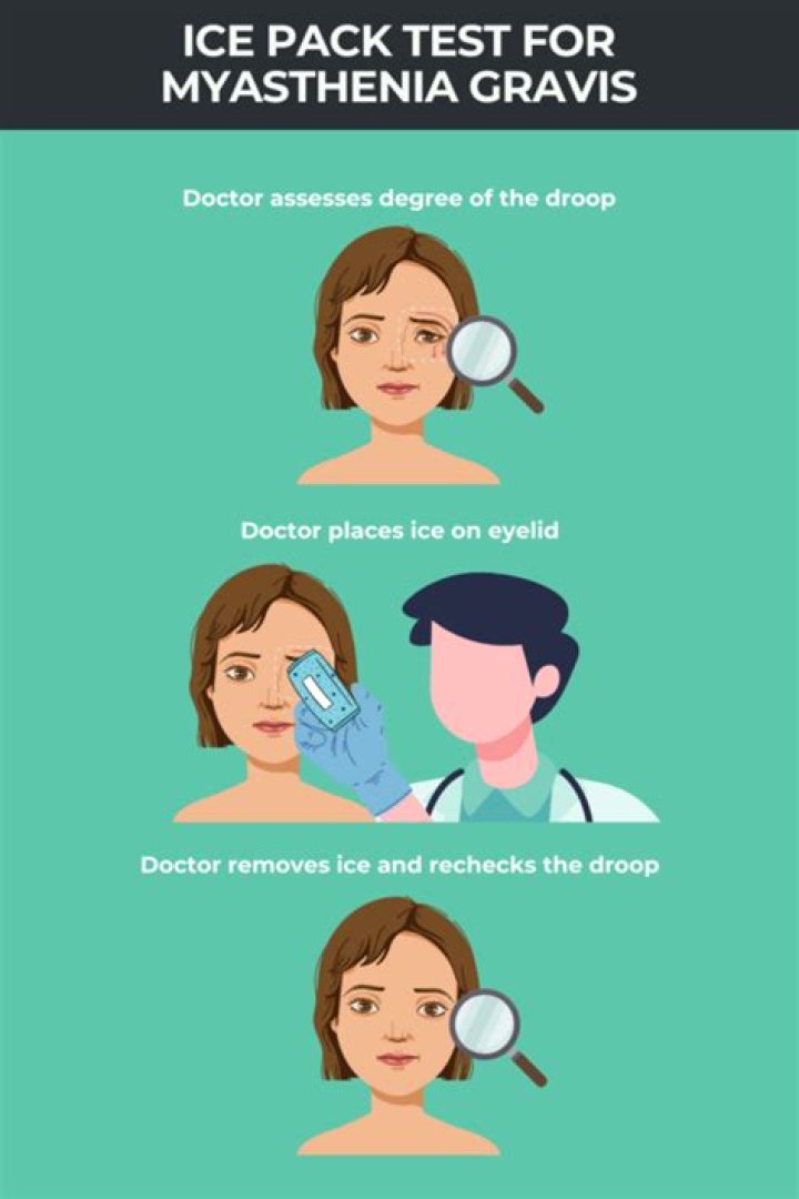 How do you test for ice in myasthenia gravis