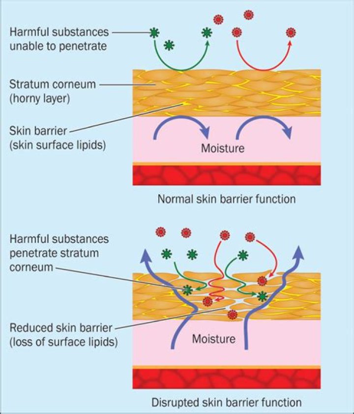 How do you treat skin breakdown from incontinence