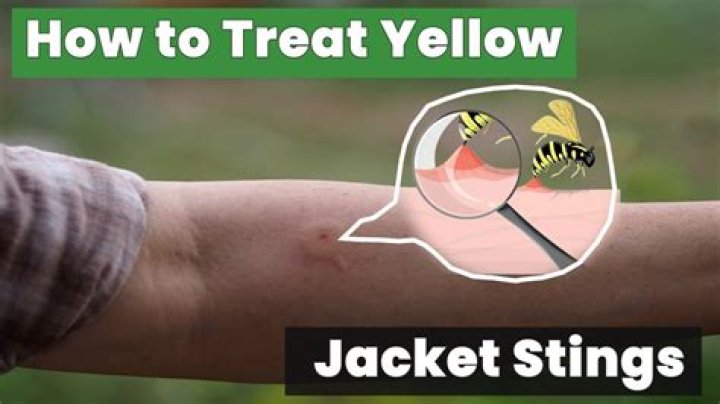 How do you treat yellow jacket stings