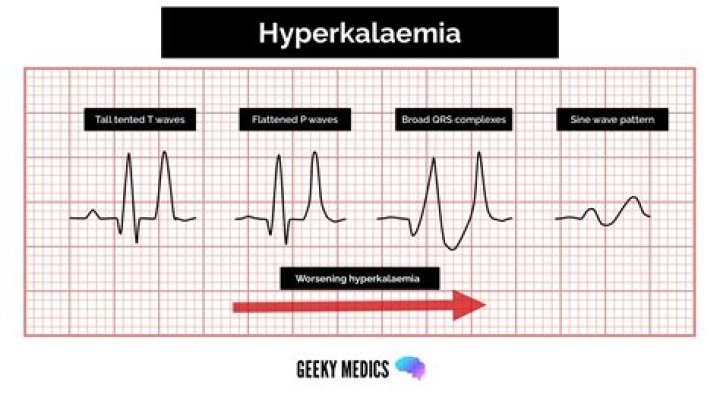 How does Hyperosmolarity cause hyperkalemia