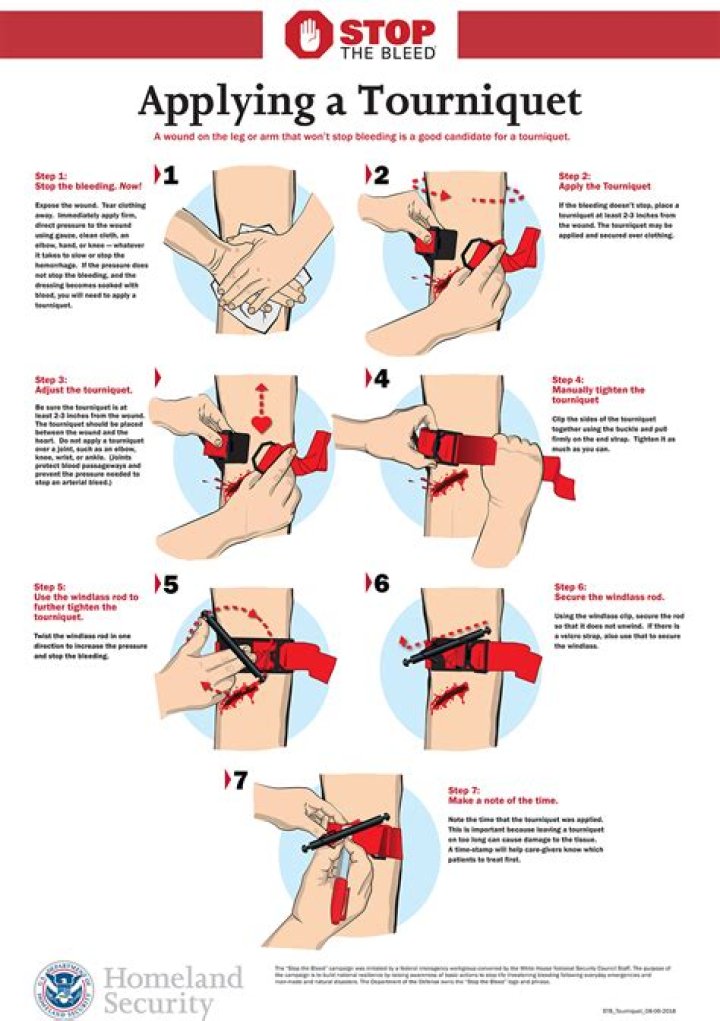 How far above the site should the tourniquet be on an arm