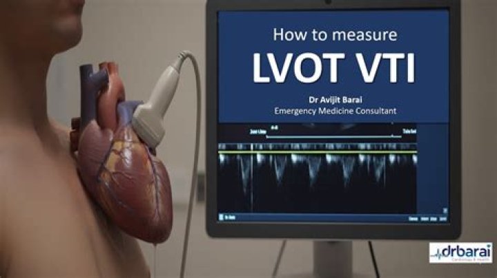 How is VTI Echo calculated