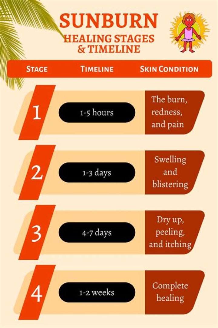 How long does it take for aloe vera to work on sunburn