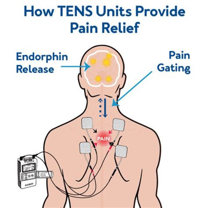 How strong should Tens be