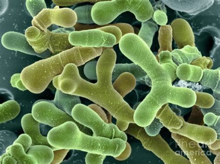 Is Bifidobacterium Animalis vegan