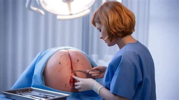 Is childbirth a medical procedure