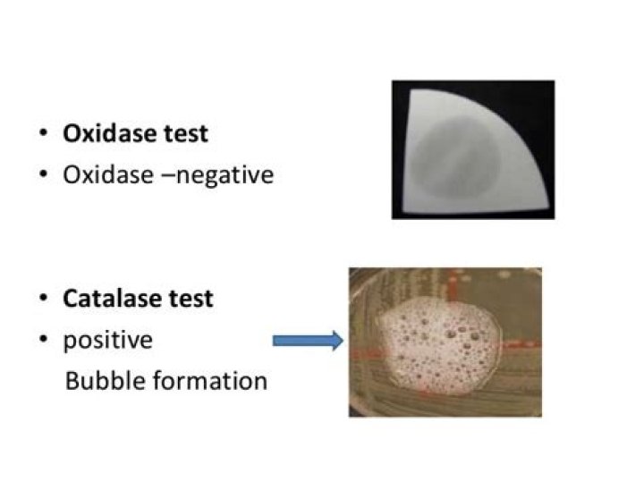 Is E coli oxidase positive or negative