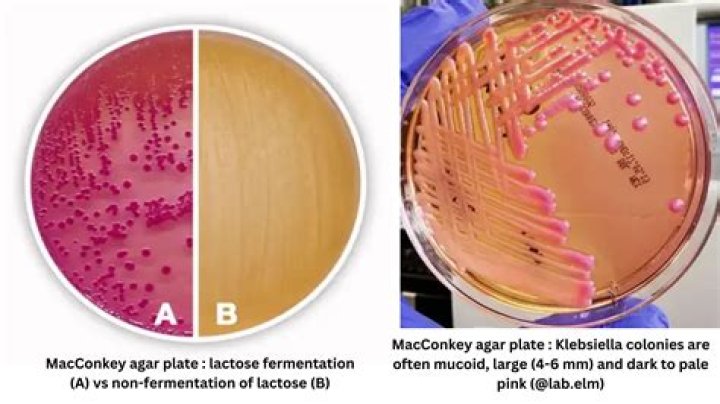 Is Klebsiella acid fast