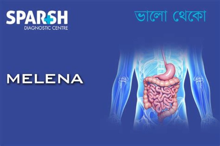 Is Melena a medical emergency