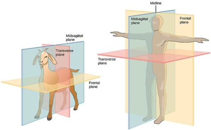 Is sagittal and Midsagittal the same