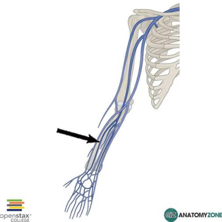 Is the radial vein superficial or deep vein