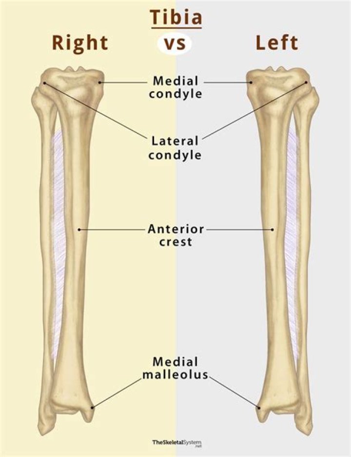 Is the tibia medial or lateral