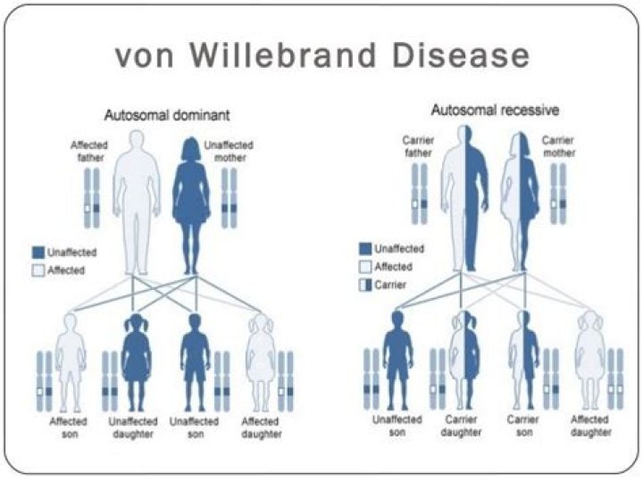 Is von Willebrand disease considered a rare disease