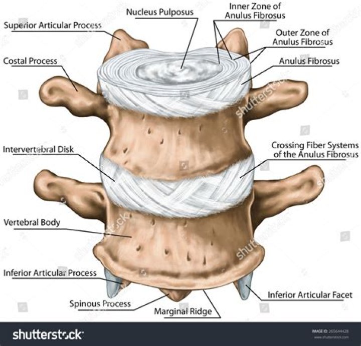 What are intervertebral discs made of and what is their function