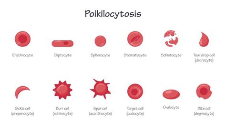 What are Poikilocytosis cells