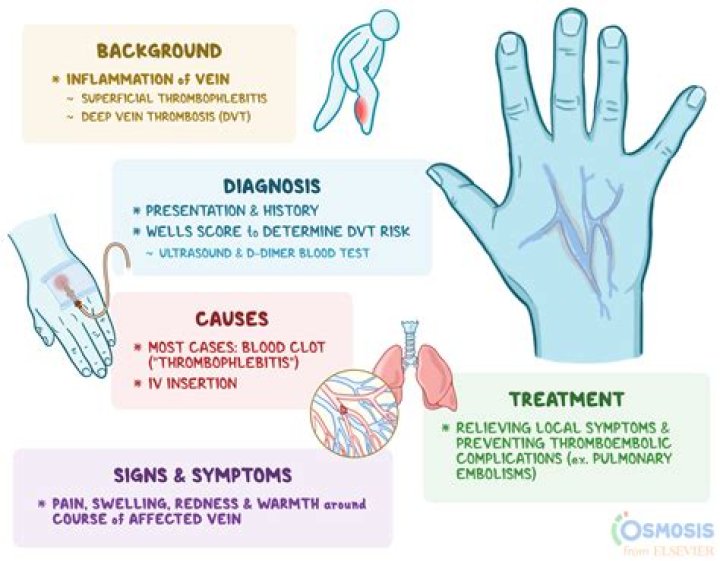 What are the 3 types of phlebitis