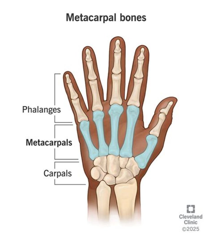 What are the 5 metacarpal bones