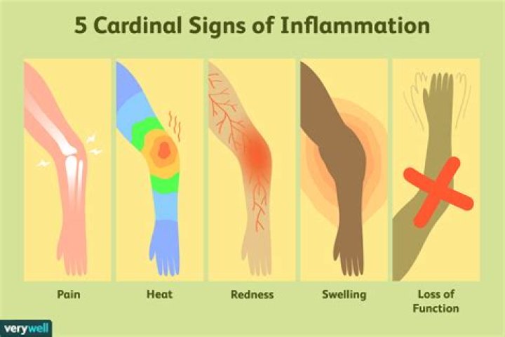 What are the cardinal signs of infection