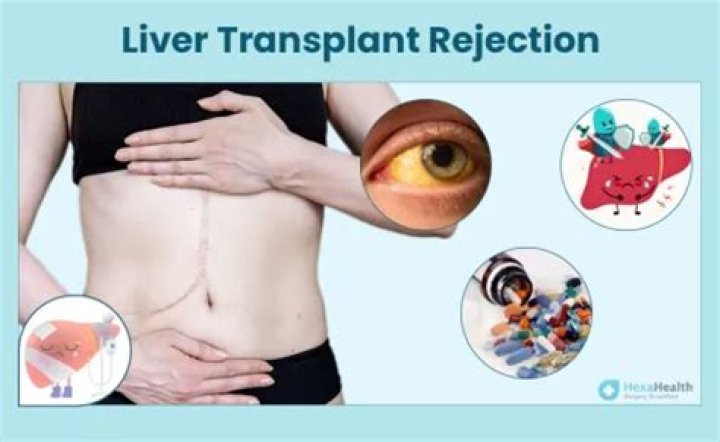 What are the signs of liver rejection