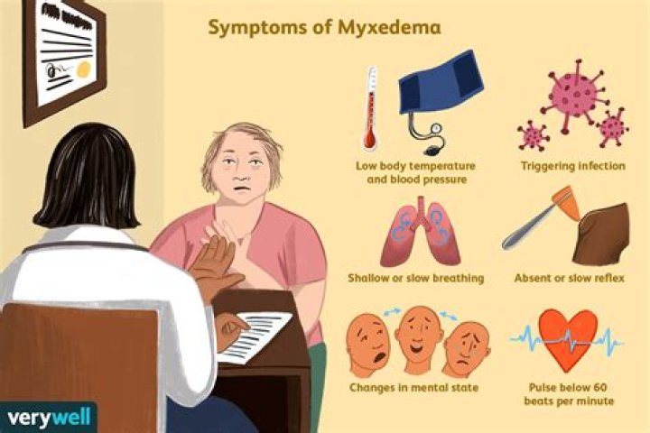 What causes myxedema crisis