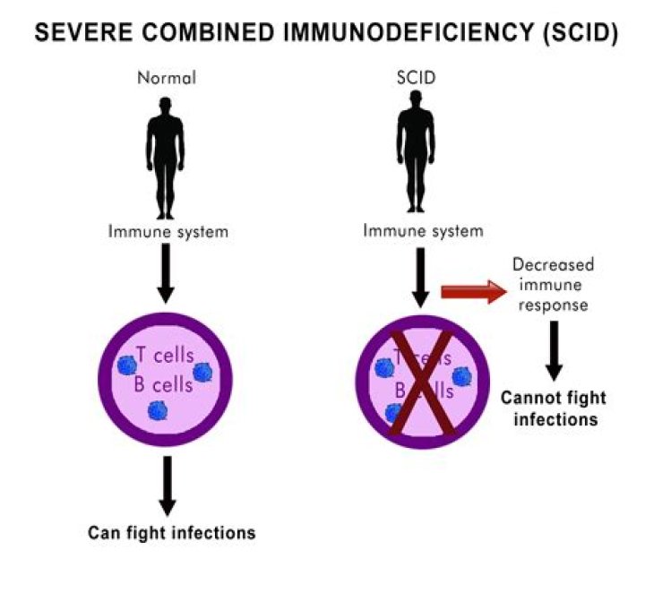 What causes SCID disease
