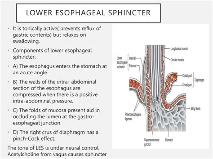 What causes weak esophageal sphincter