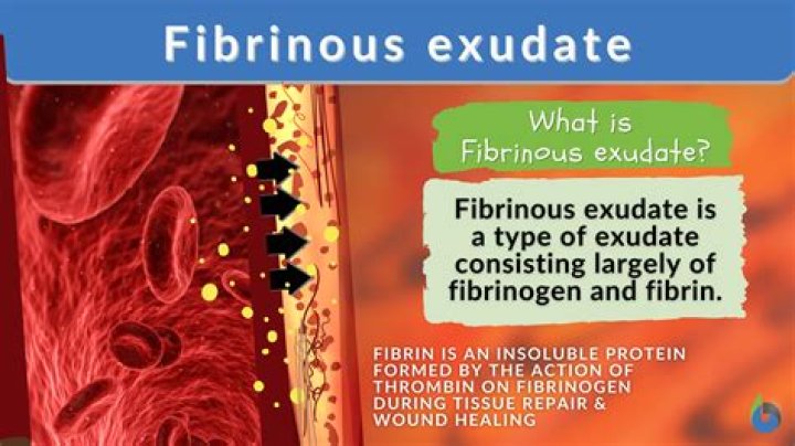 What color is fibrinous exudate