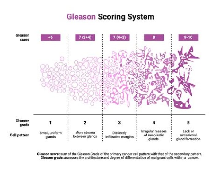 What does a Gleason score of 9 mean