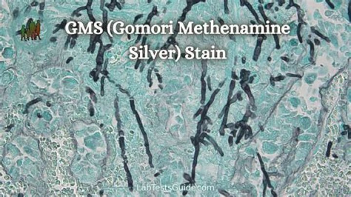 What does a GMS Stain highlight
