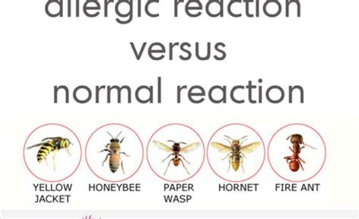 What does an allergic reaction to a bee sting look like