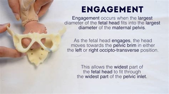 What does fetal engagement mean