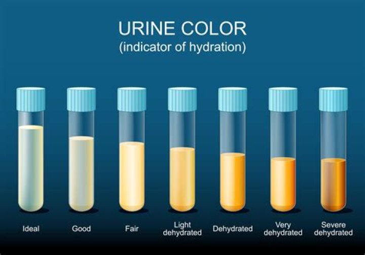 What does it mean if your urine is clear